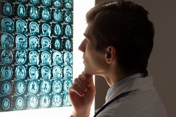 What is Traumatic Brain Injury?